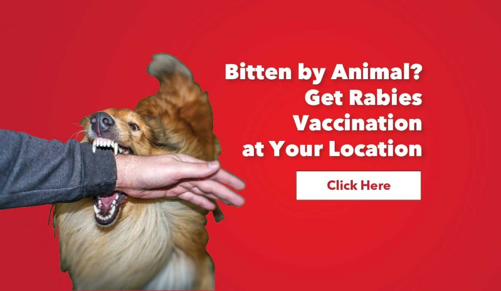 Rabies Treatment After Dog Bite Learn What to Do If Bitten by a Dog
