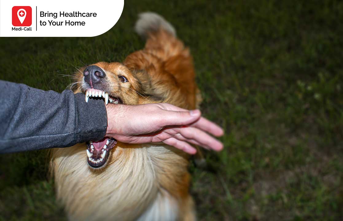 Rabies Treatment After Dog Bite Learn What To Do If Bitten By A Dog