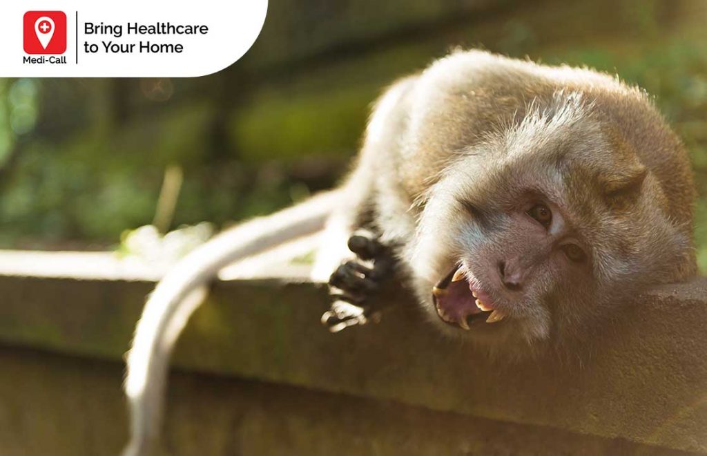 Signs of Rabies in Wild Animals: Learn the Signs of an Infected Animal