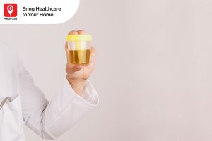 hep a symptoms and treatment, hepatitis A, medi-call, medicall