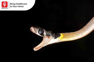 snake bite first aid, Medi-Call, Medicall