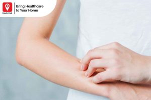 sudden peanut allergy adults, Medicall, Medi-Call