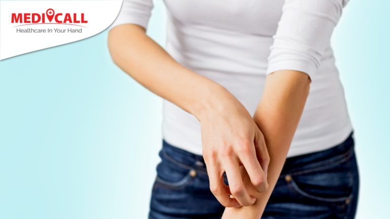 menghilangkan bentol, cara menghilangkan bentol, bentol merah pada kulit, bentol merah dan gatal, solusi bentol merah