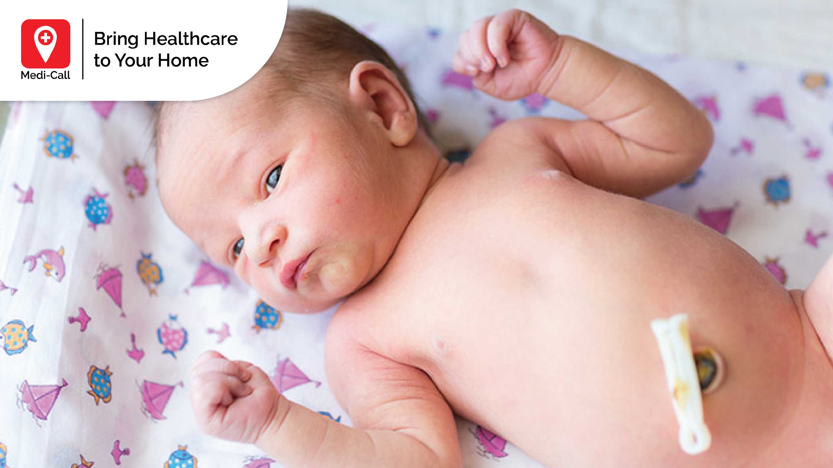 Ini Cara Merawat Tali Pusat Bayi Baru Lahir yang Tepat
