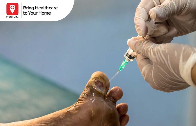 penyebab gangren diabetes, luka gangren, perawatan luka gangren, Medicall, Medi-Call