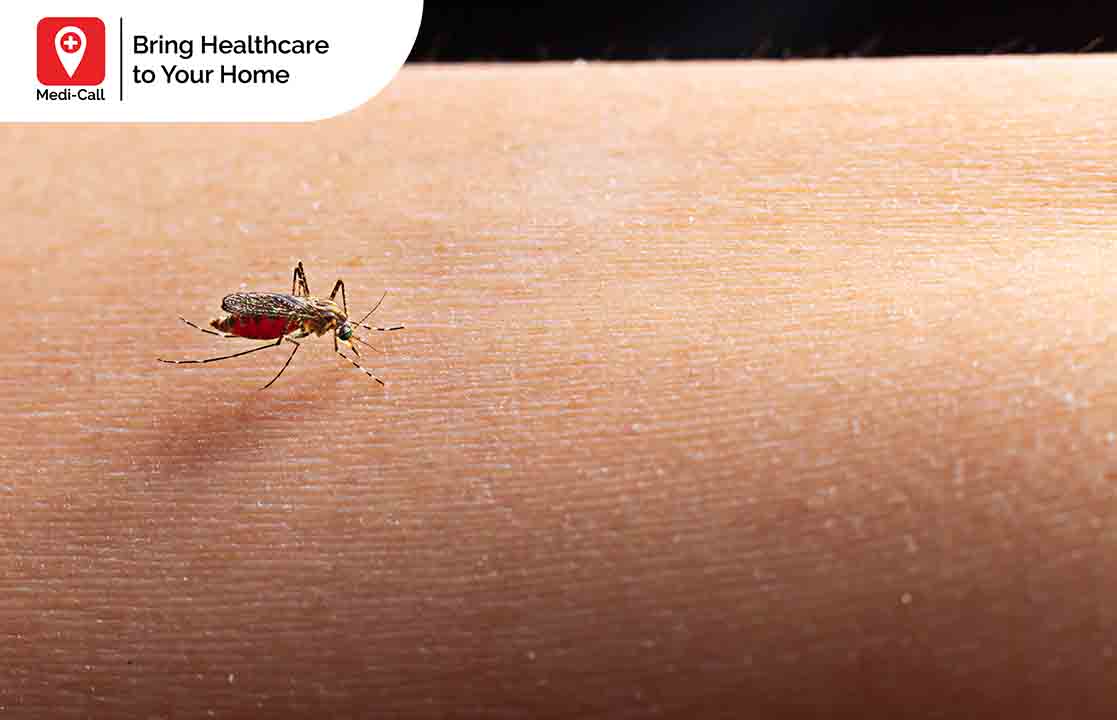 masa inkubasi virus demam berdarah dengue, dbd, nyamuk demam berdarah, Medicall, Medi-Call