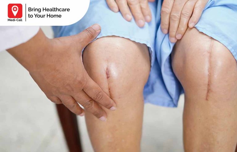 penyebab nanah pada luka operasi, Medicall, Medi-Call