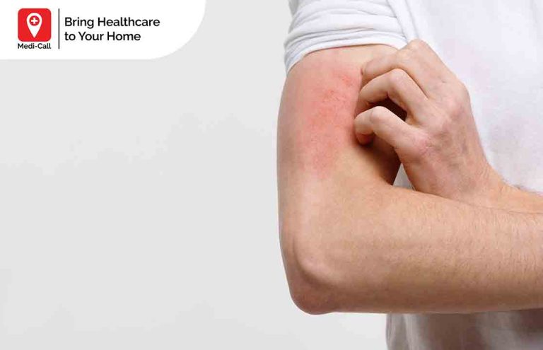 badan gatal gatal tanpa sebab, mengatasi gatal-gatal, Medicall, Medi-Call