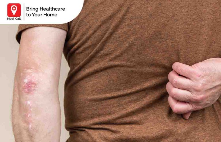 luka diabetes di punggung pada lansia Medi-Call