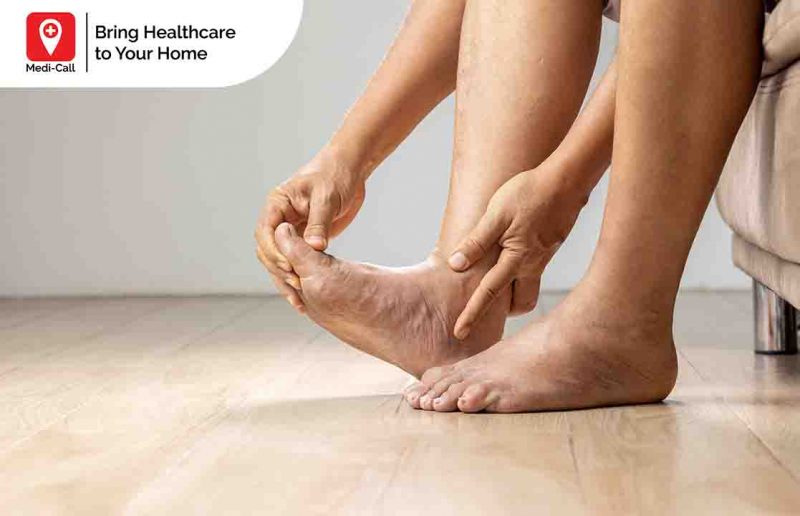 Cara Mengobati Kaki Bengkak Karena Jatuh yang Efektif Selain Pijat