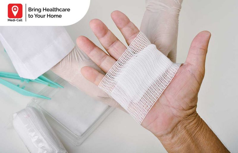 Cara Perawatan Luka Modern Dressing, Lebih Nyaman dan Tidak Nyeri