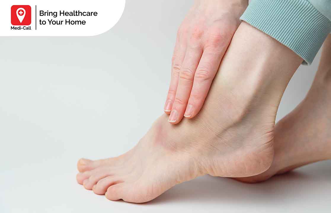obat kaki bengkak alami karena luka infeksi Medi-Call