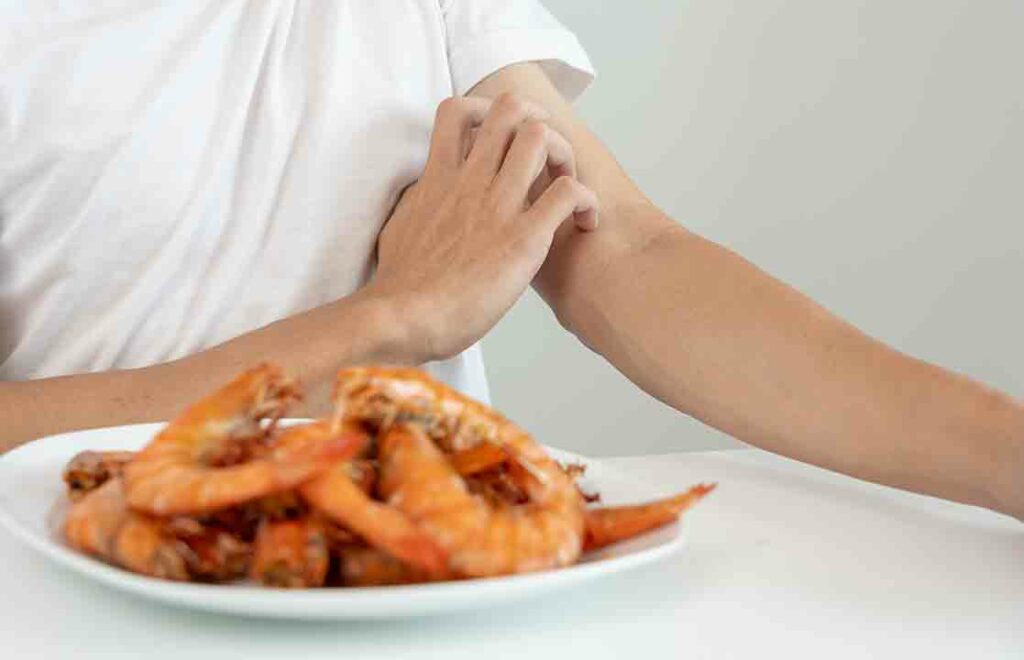 Penyebab Alergi Udang Medi-Call