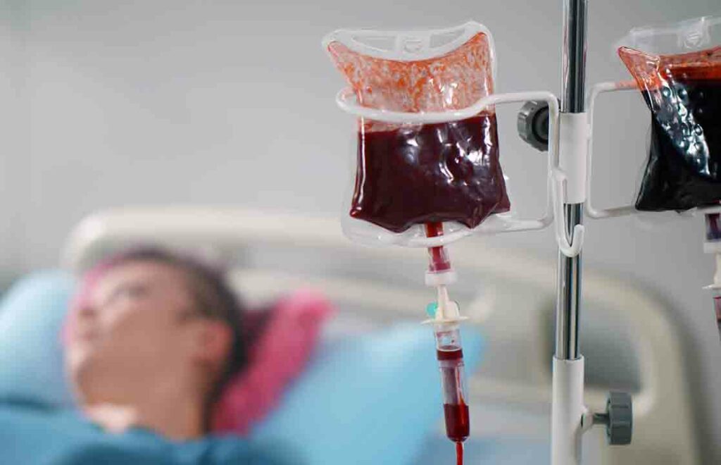 Anemia Aplastik Disebabkan Oleh