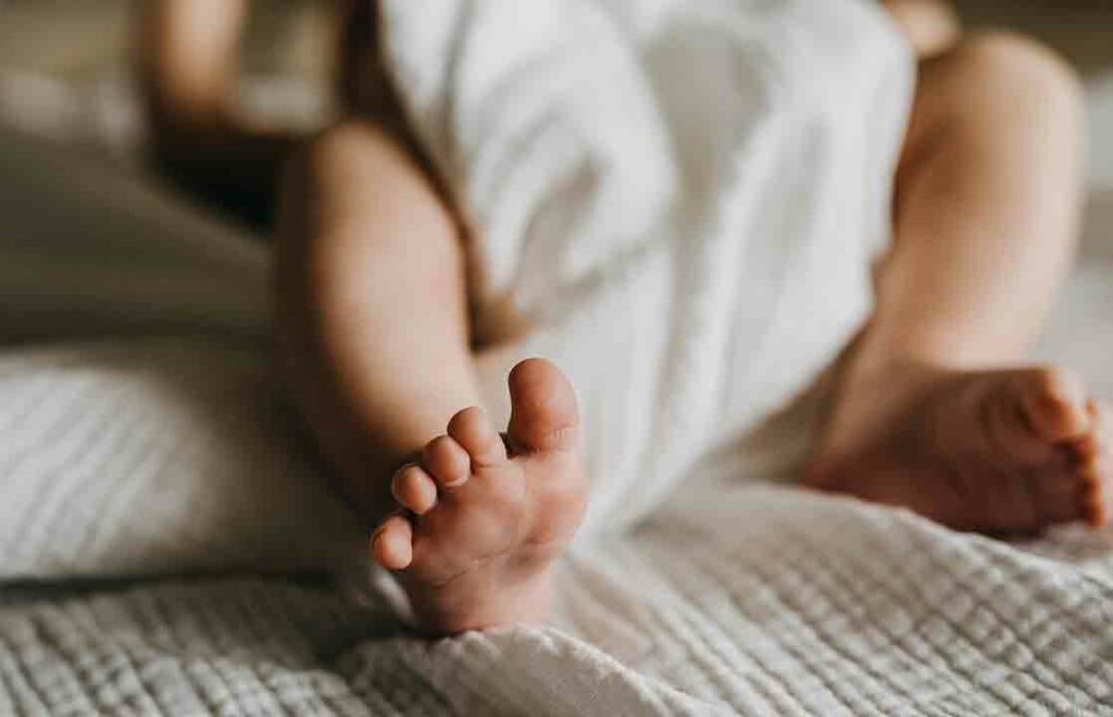 Penyakit Kuning pada Bayi Medi-Call