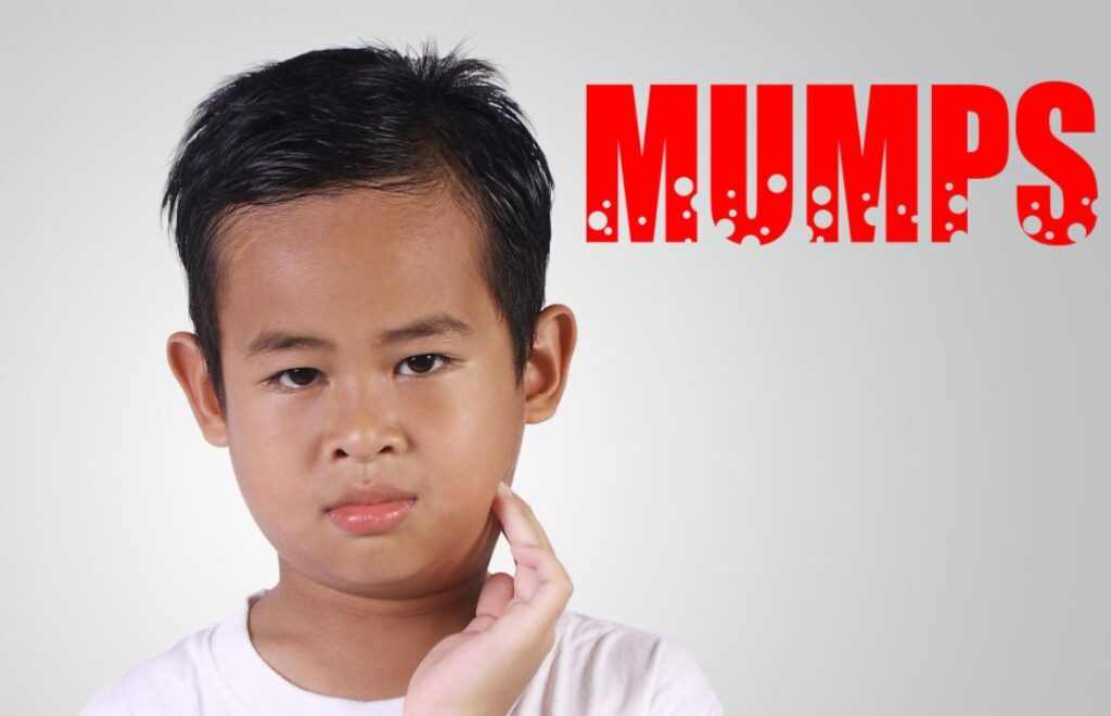 Ciri Ciri Gondongan yang Perlu Diwaspadai, Ini Penjelasannya Medi-Call